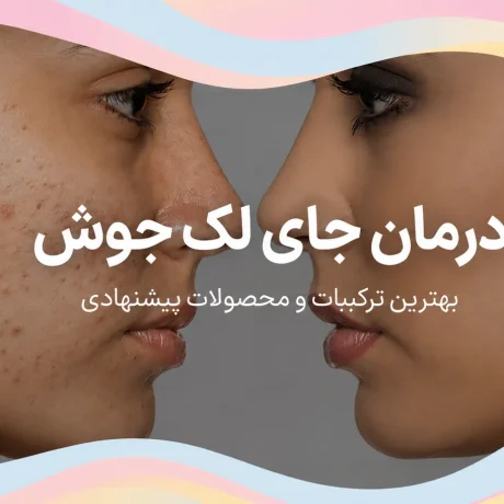 درمان لک جای جوش